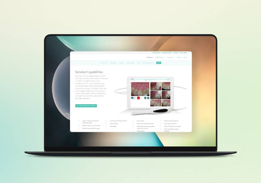 MatExLook case image